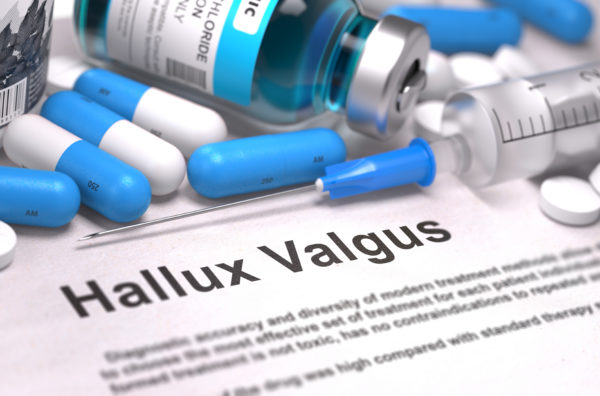 zdravila proti bolečinam po operaciji hallux valgus