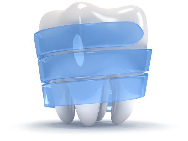 ilustracija belilnega sredstva okoli belega zoba