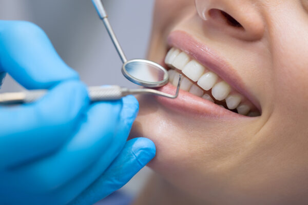 Ženska z lepim nasmehom na pregledu pri zobozdravniku.